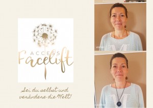 Facelift_Sabine